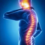 Nerve Pain